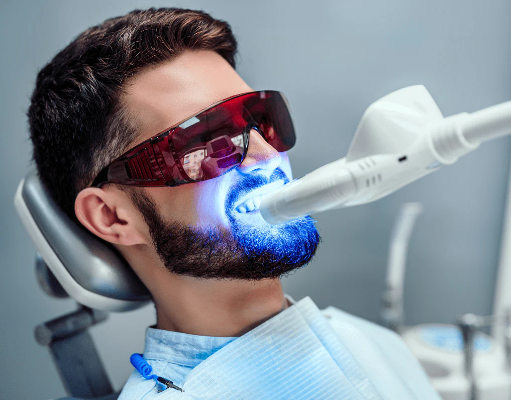 Blanchiment des dents