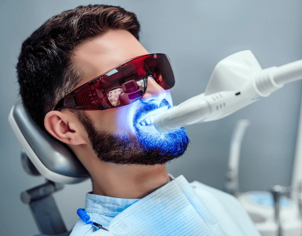 Blanchiment des dents au cabinet dentaire